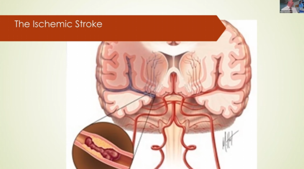 A Field Guide to Strokes (2023)